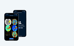 StrokeViewer